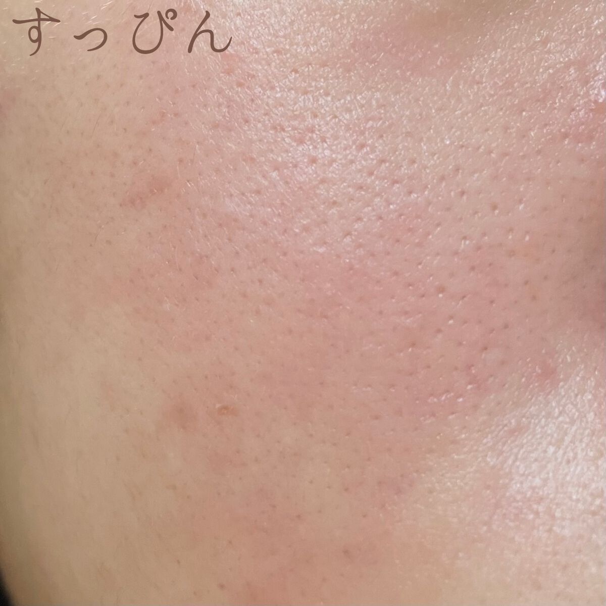 (旧)アンリミテッド ラスティング フルイド/shu uemura/リキッドファンデーションを使ったクチコミ(3枚目)