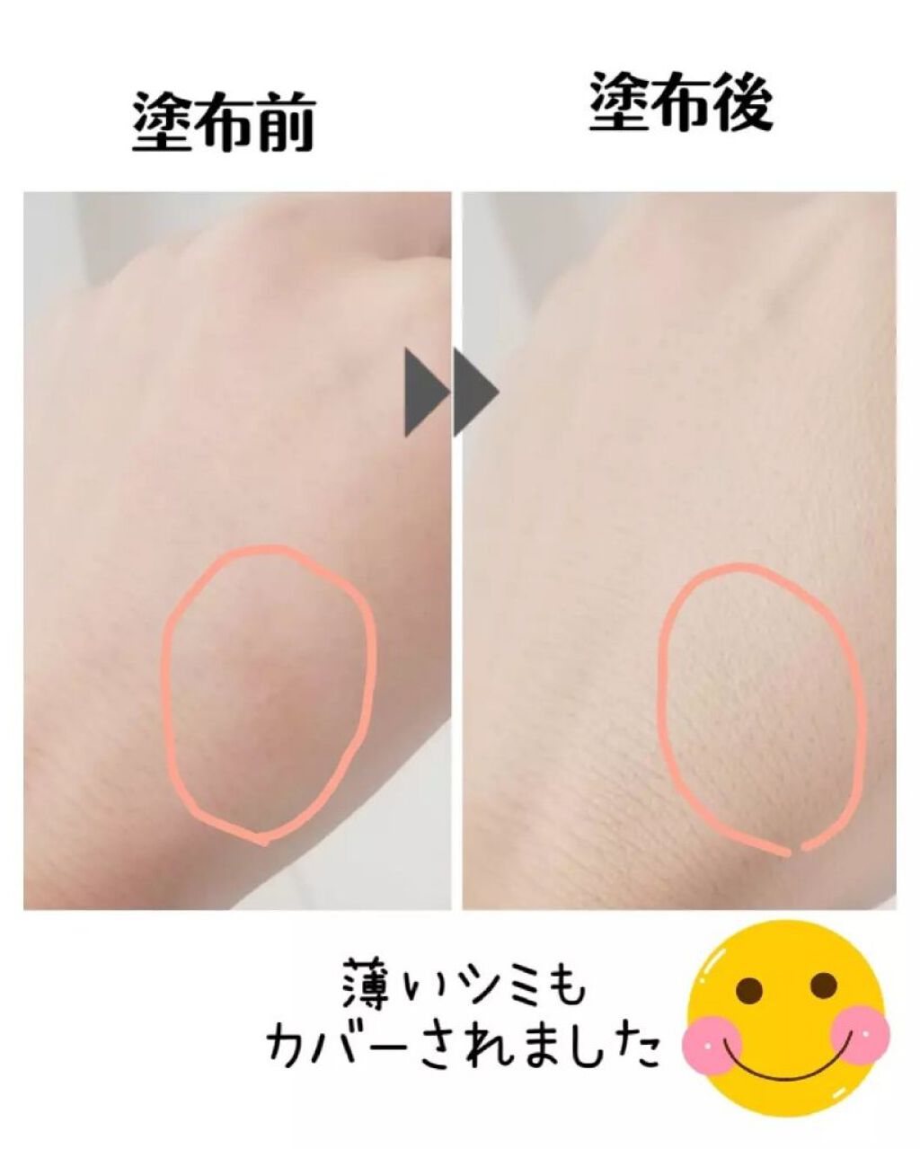 ピンクティーツリーカバークッション/APLIN/クッションファンデーションを使ったクチコミ(4枚目)