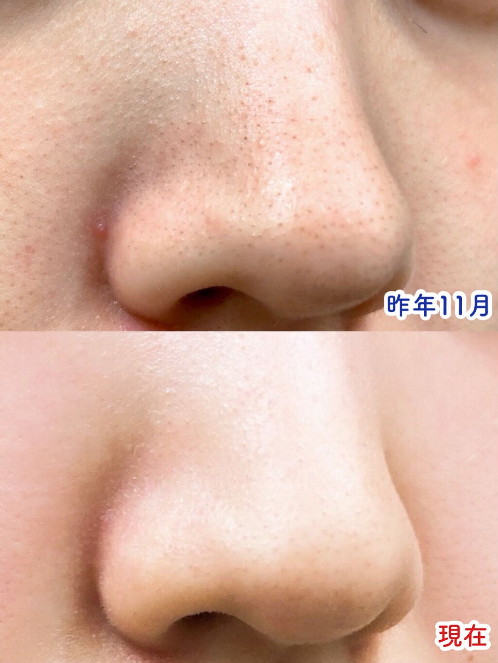 フルモア Sパウダーウォッシュ/FRU MOR/洗顔パウダーを使ったクチコミ(2枚目)