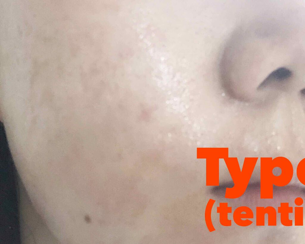 Updating Mask 1.0.0 5タイプセット 1セット5枚入り/meol/シートマスク・パックを使ったクチコミ(2枚目)