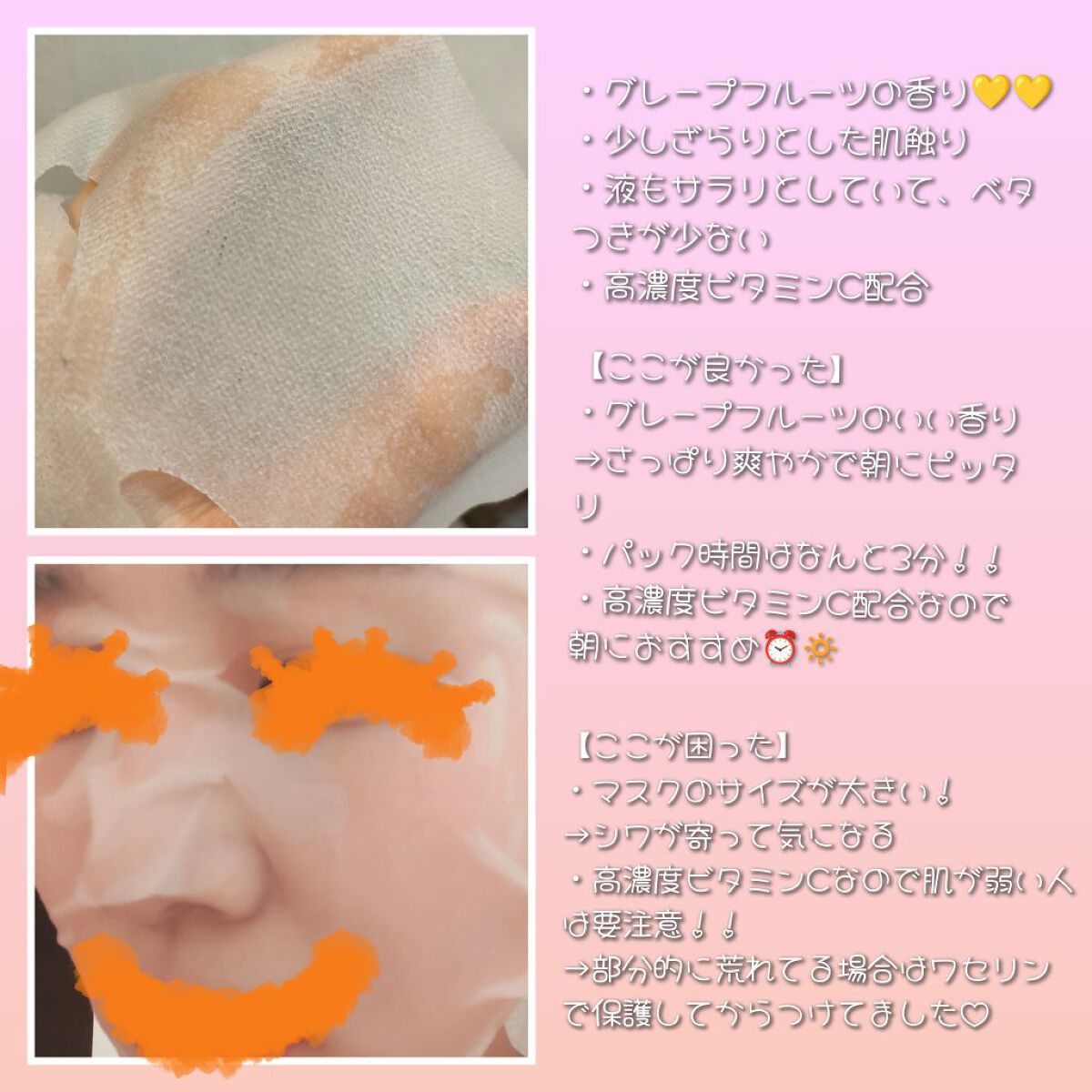 ダーマレーザースーパーVC100マスク/クオリティファースト/シートマスク・パックを使ったクチコミ（2枚目）