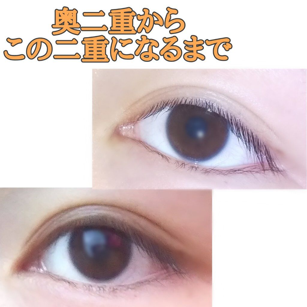 防水透明バン/DAISO/その他を使ったクチコミ（1枚目）