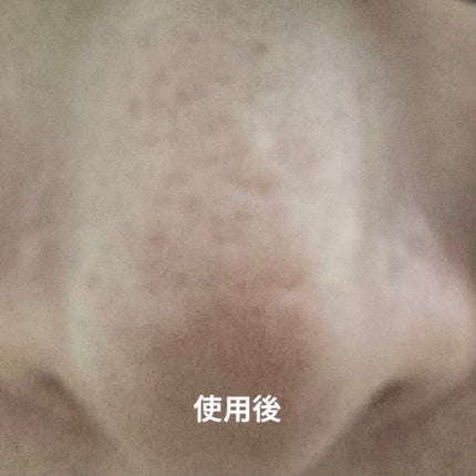 ノーモアブラックヘッド(ノーズピーリング)/One-day's you/スクラブ・ゴマージュを使ったクチコミ(3枚目)