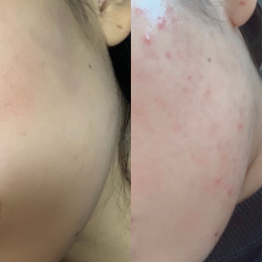 I.P.IライトマックスAPマスクEX/MEDIHEAL/シートマスク・パックを使ったクチコミ（2枚目）