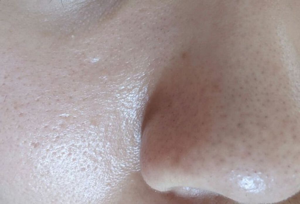 エッセンスローション/ヒフミド/化粧水を使ったクチコミ（3枚目）