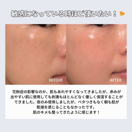 バイオームバリアパンテンシブクリーム/UIQ/フェイスクリームを使ったクチコミ(5枚目)