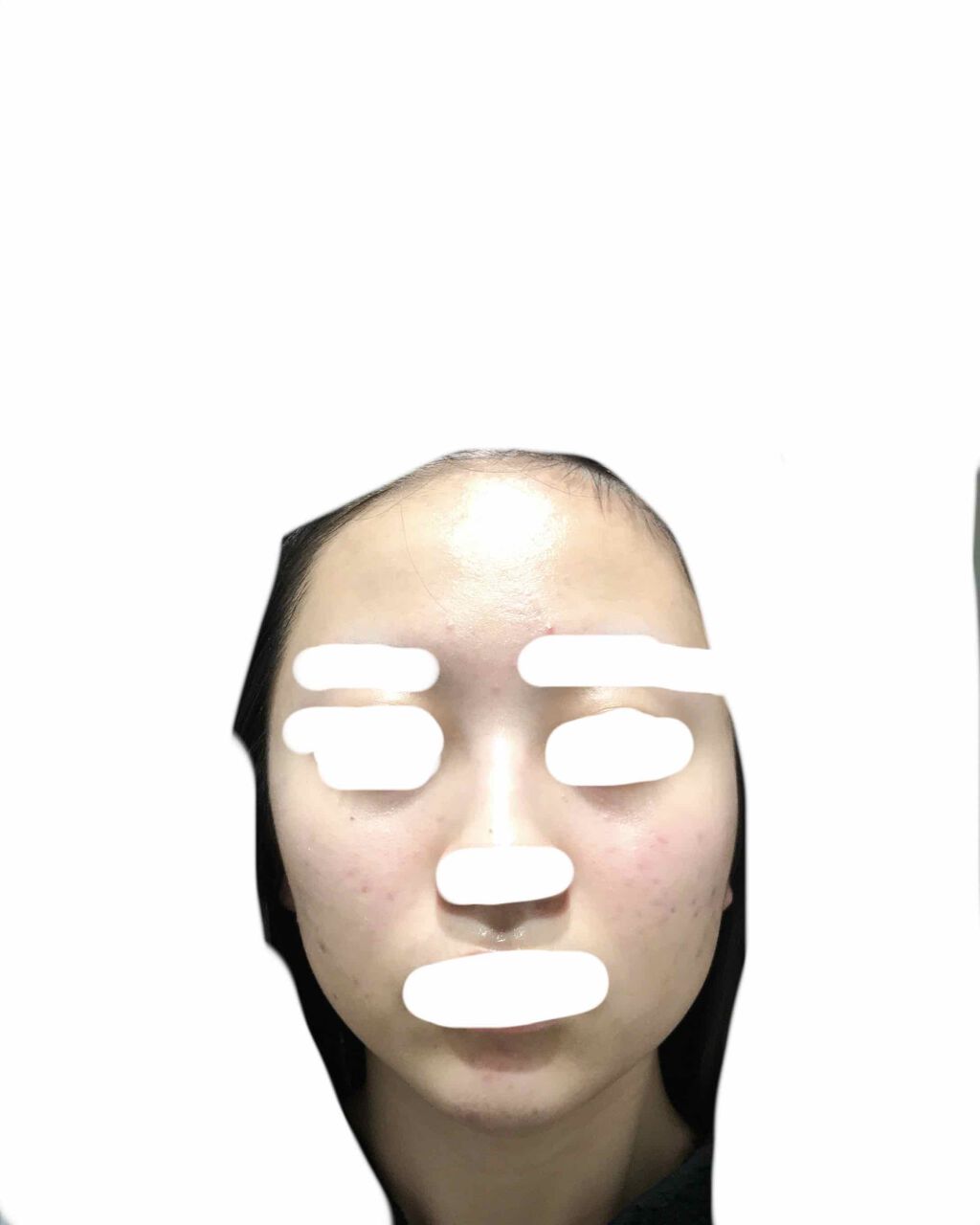 十味敗毒湯(医薬品)/ツムラ/その他を使ったクチコミ（3枚目）