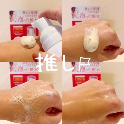 フェルゼアプレミアム 薬用泡の化粧水/フェルゼア/化粧水を使ったクチコミ(1枚目)
