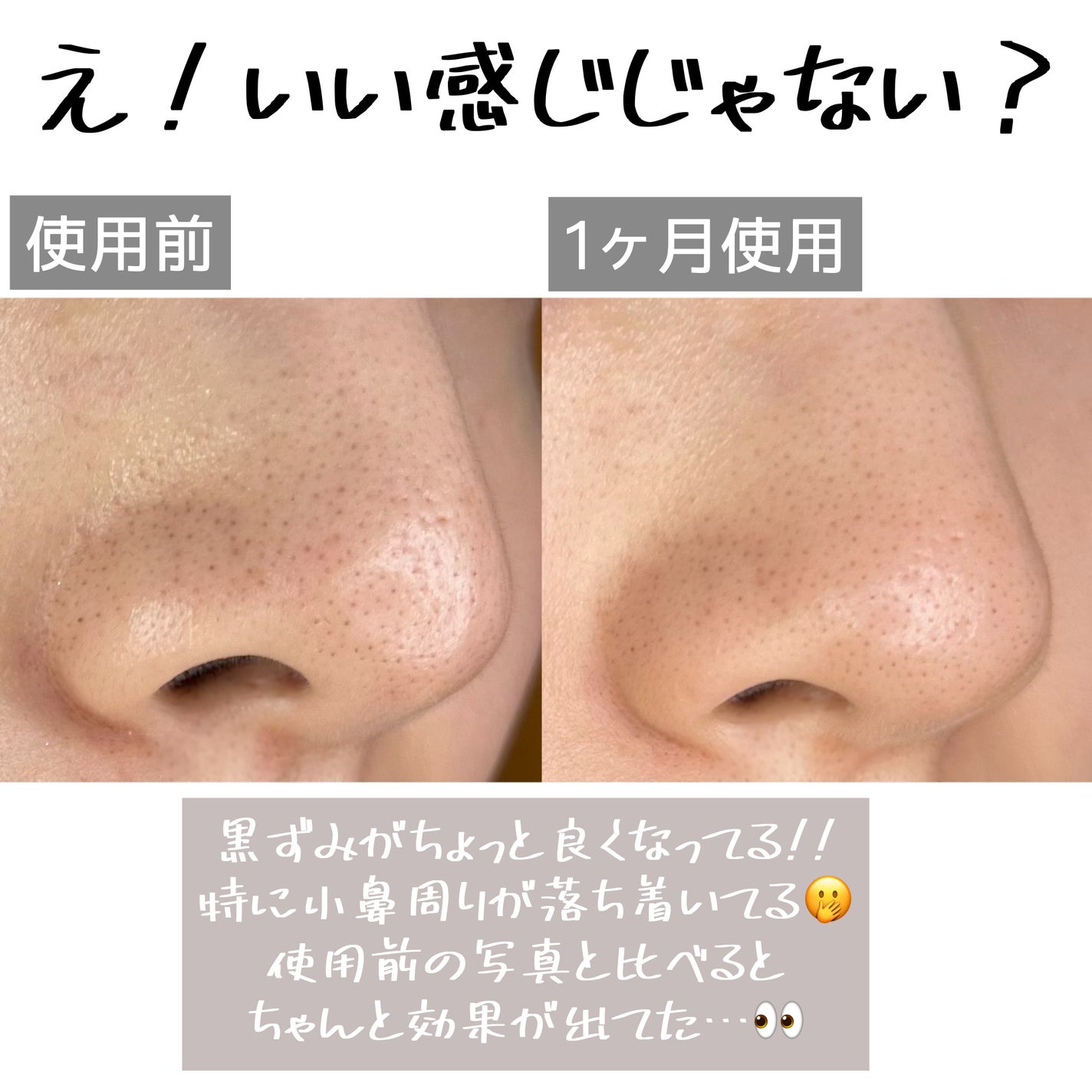 Cエッセンス VC5+PLUS /EBiS化粧品/美容液を使ったクチコミ(5枚目)