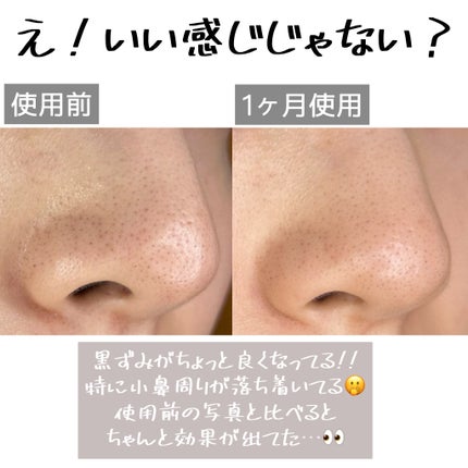 Cエッセンス VC5+PLUS /EBiS化粧品/美容液を使ったクチコミ(5枚目)