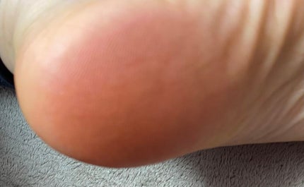 かかとちゃん/桐灰化学/レッグ・フットケアを使ったクチコミ(2枚目)