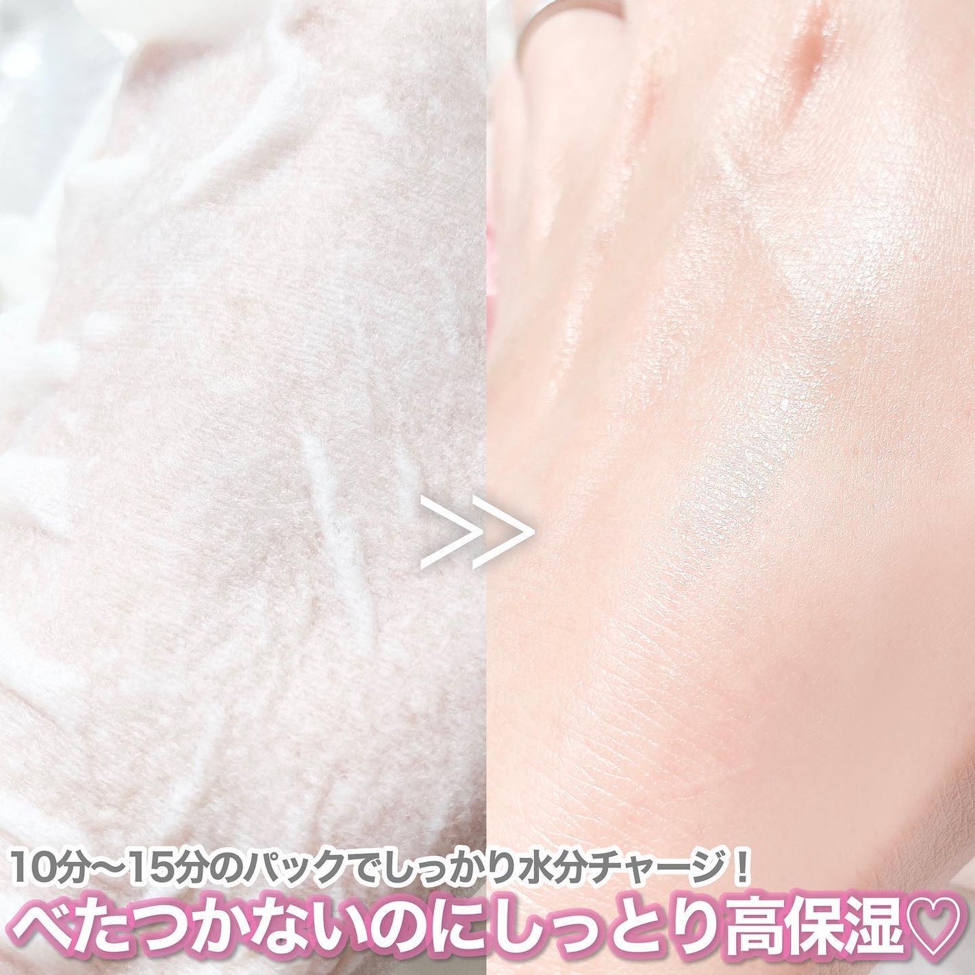 トリデン ダイブインマスクパック/Torriden/シートマスク・パックを使ったクチコミ(5枚目)