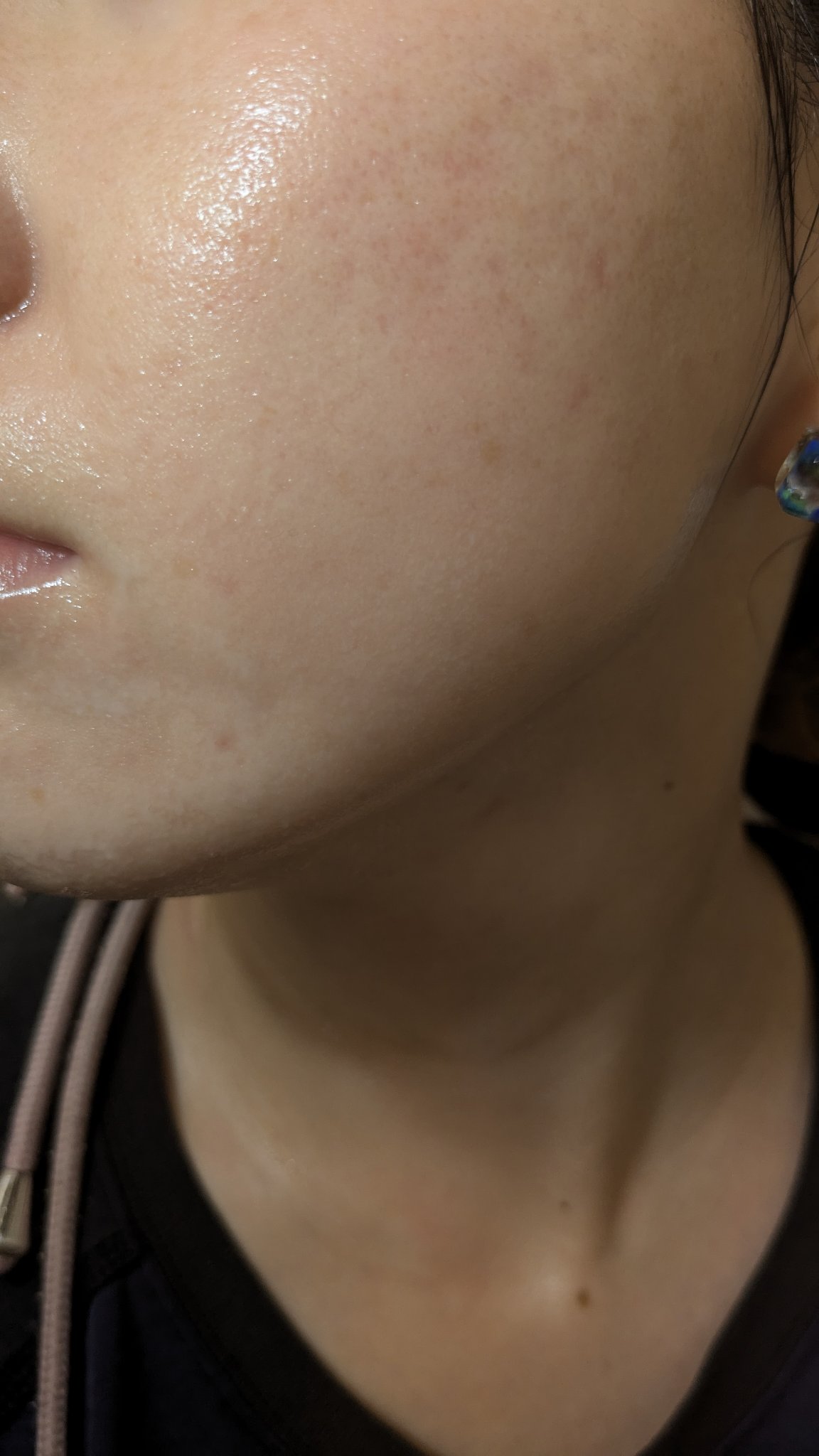 クリーム NC/なめらか本舗/フェイスクリームを使ったクチコミ（2枚目）