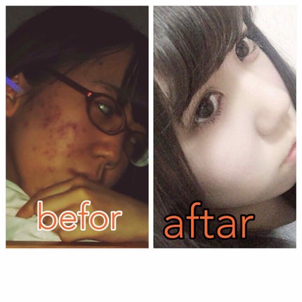 テラ・コートリル 軟膏(医薬品)/ジョンソン・エンド・ジョンソン/その他を使ったクチコミ(2枚目)