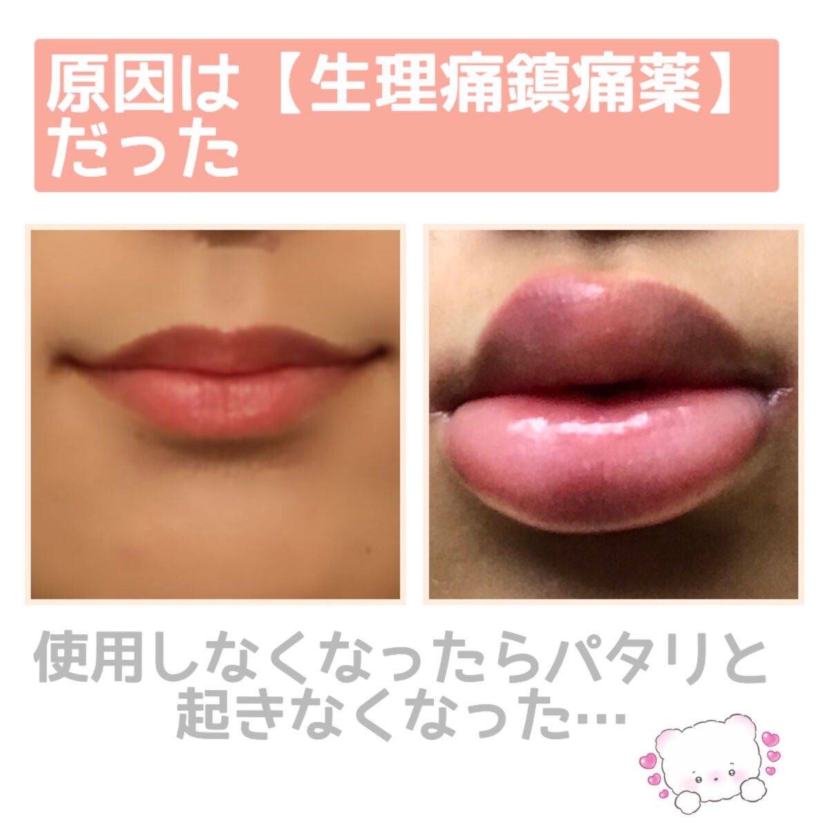 ノーシンピュア(医薬品)/アラクス/その他を使ったクチコミ(3枚目)