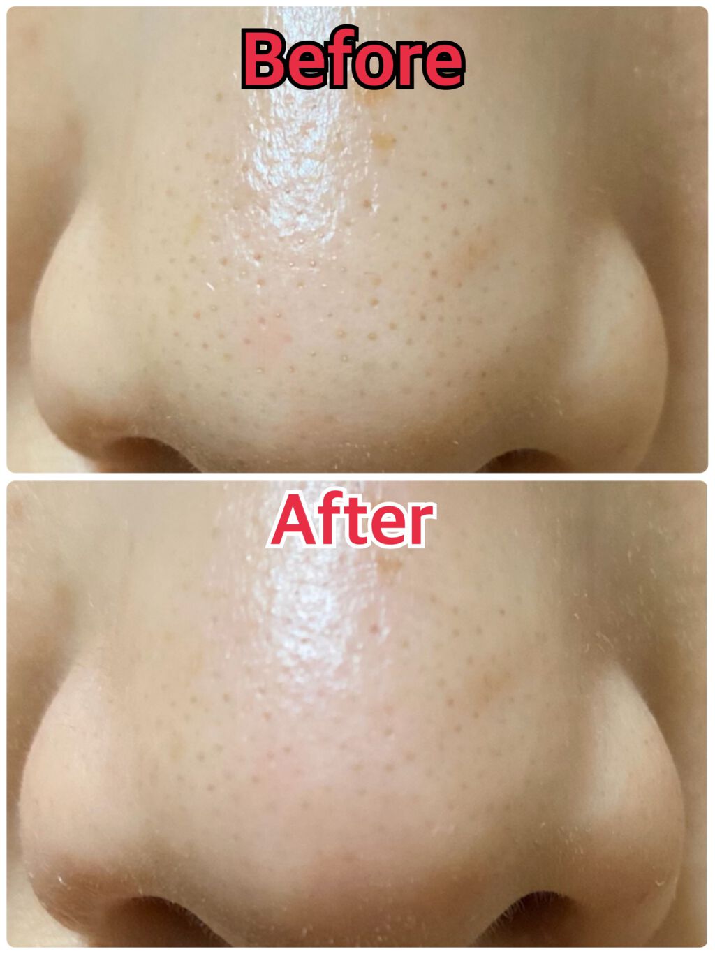 ホワイト もこもこ白泡マスク/リッツ/洗い流すパック・マスクを使ったクチコミ（3枚目）