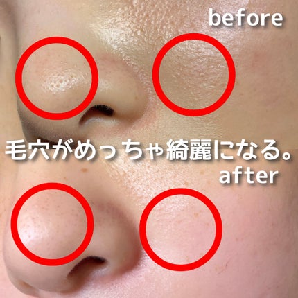 ビオレ おうちdeエステ メイク落とし マッサージブラックジェル/ビオレ/クレンジングジェルを使ったクチコミ(4枚目)