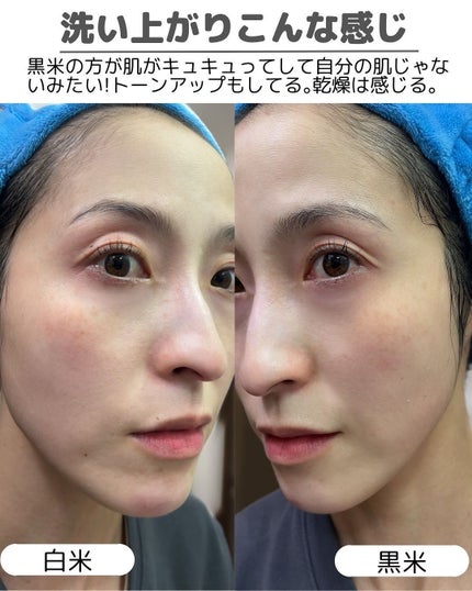 白米ピールショットゴマージュアンプル/Dr.Melaxin/美容液を使ったクチコミ(7枚目)