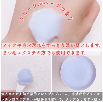 夢みるバーム アクネクリアモイスチャー/ロゼット/クレンジングバームを使ったクチコミ(2枚目)
