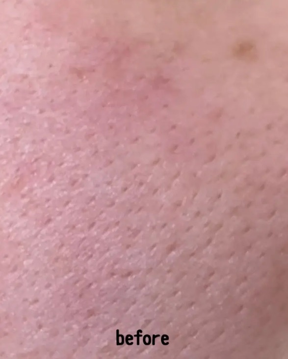 レチノール　シカ　リペア　セラム/innisfree/美容液を使ったクチコミ（2枚目）