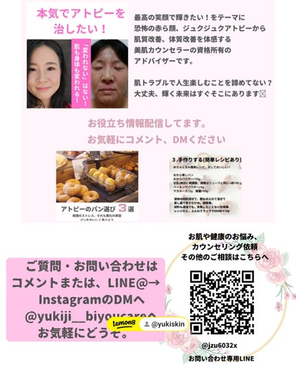 美肌カウンセラー💆肌悩みを解決し見る世界を変える on LIPS 「肌を綺麗にする専門家💆肌荒れ難民族だったわたしが"シミ改善のた..」(8枚目)