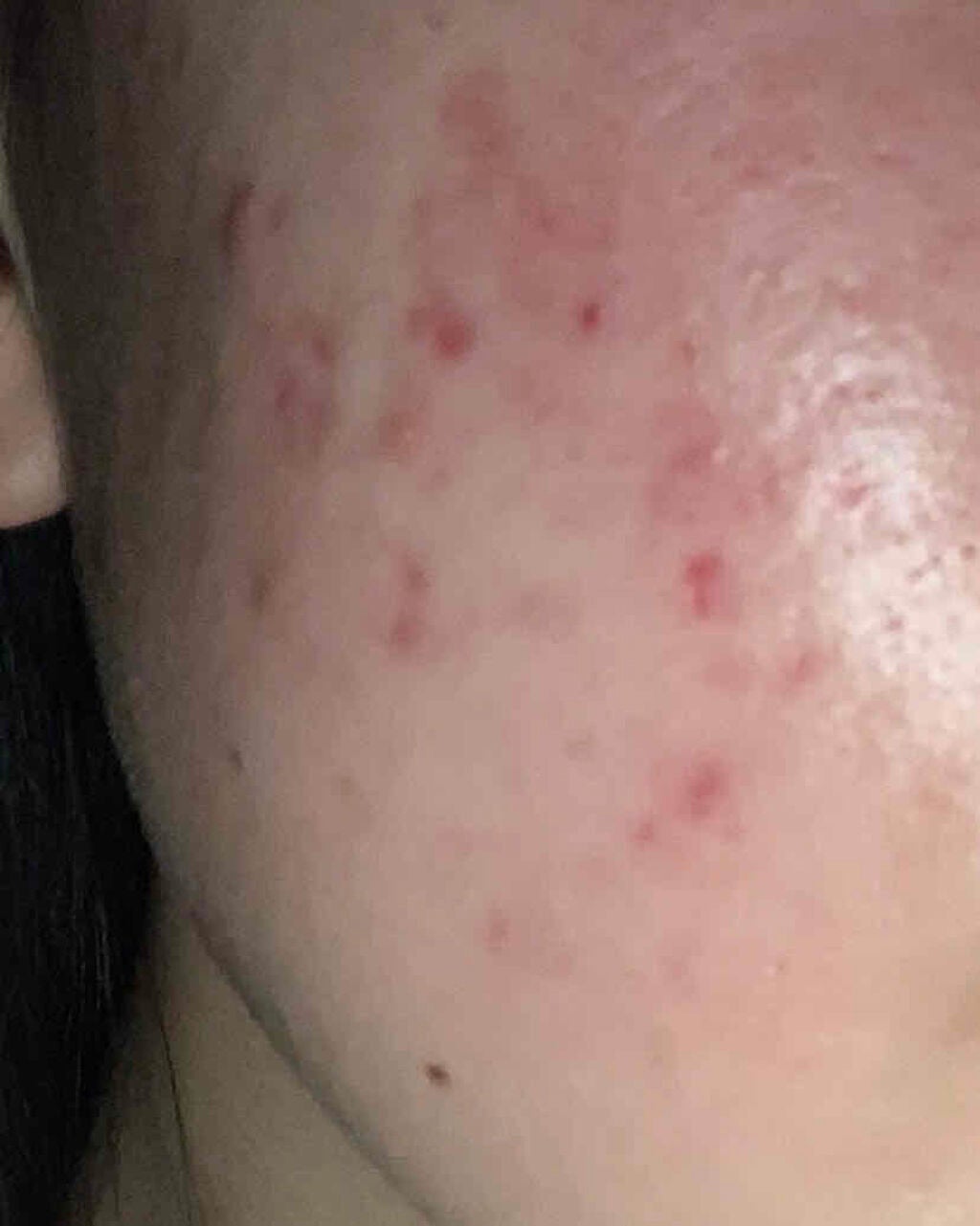 エスカメル(医薬品)/佐藤製薬/その他を使ったクチコミ(1枚目)