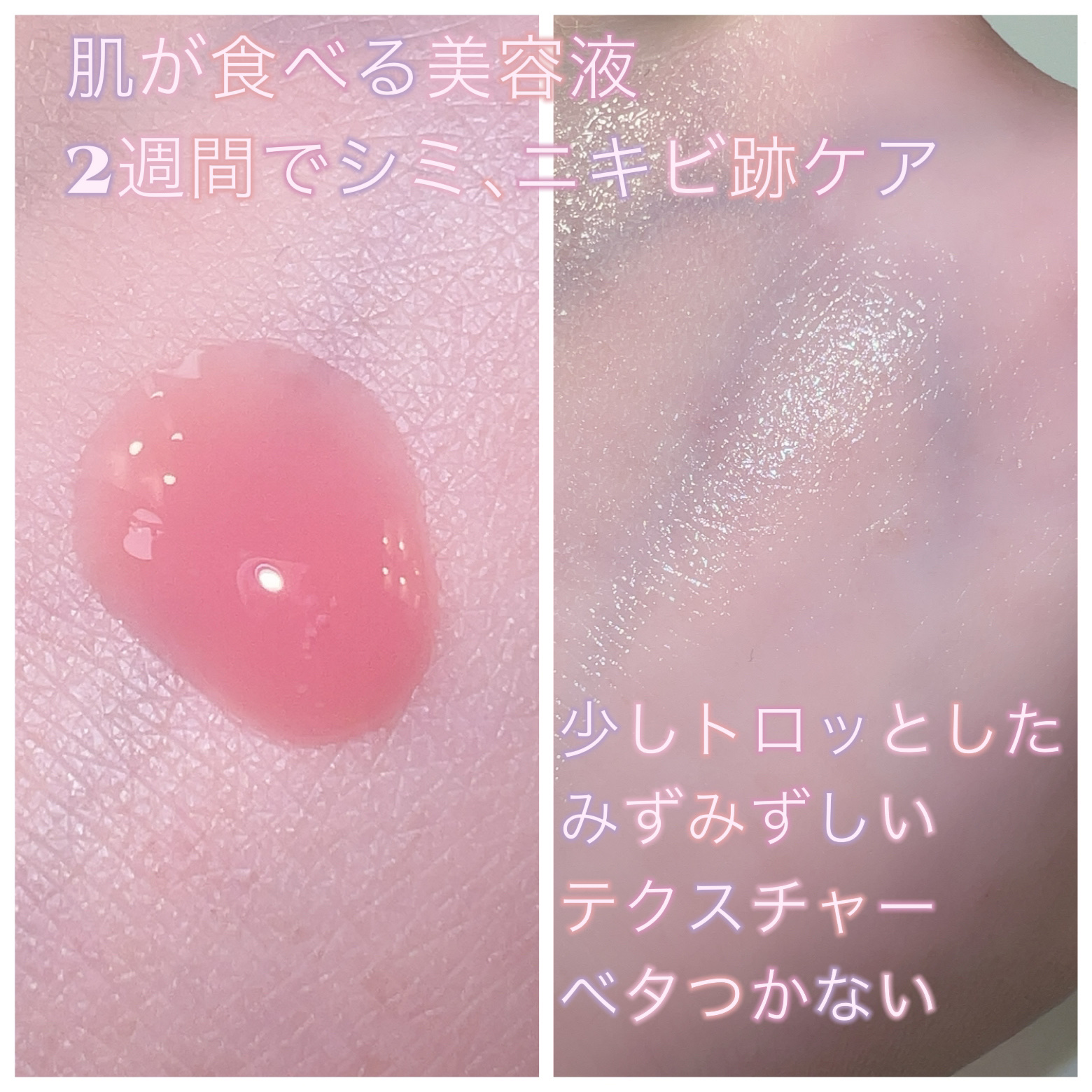 PDRNピンクコラーゲンゲルマスク/MEDICUBE/シートマスク・パックを使ったクチコミ（2枚目）