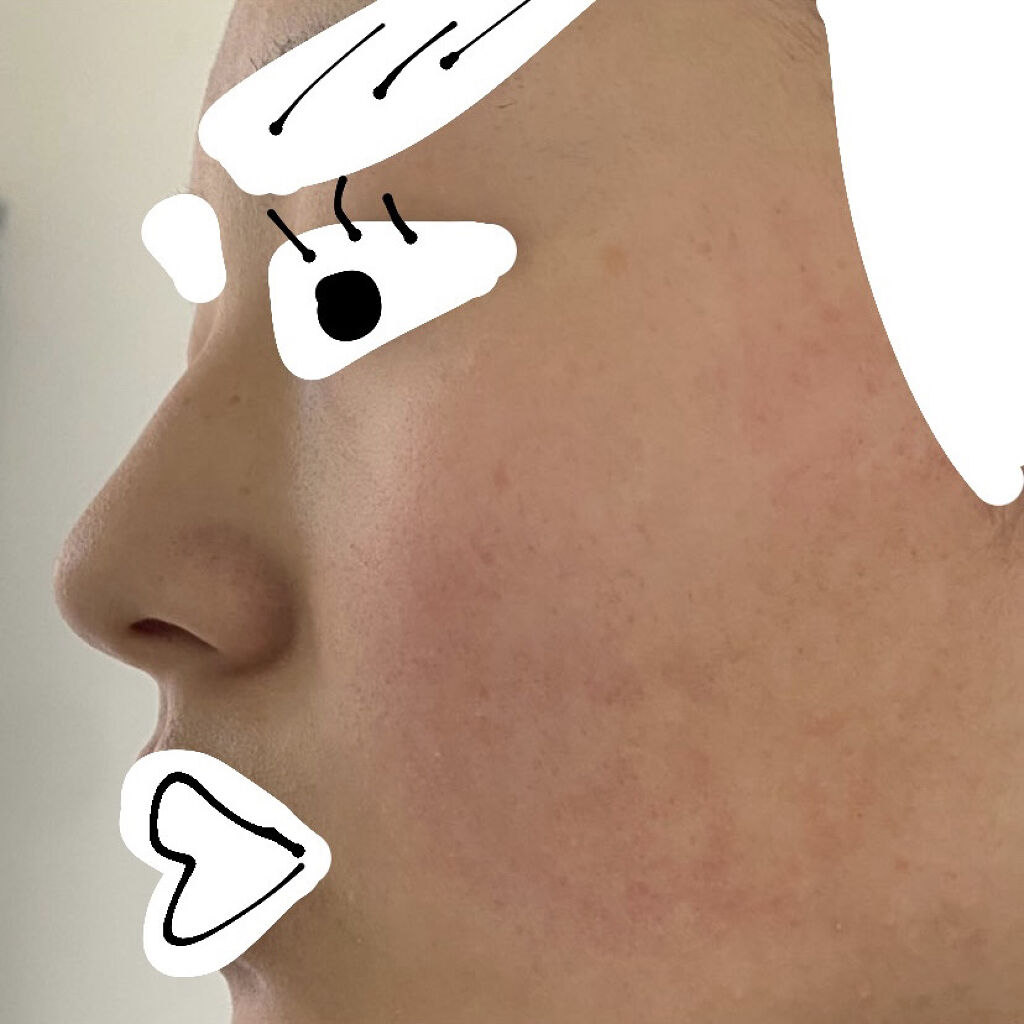 ティーツリーケア ソリューション エッセンシャルマスクEX/MEDIHEAL/シートマスク・パックを使ったクチコミ（2枚目）