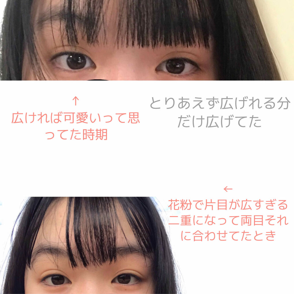 のびーるアイテープ（絆創膏タイプ、レギュラー）/DAISO/二重まぶた用アイテムを使ったクチコミ（2枚目）