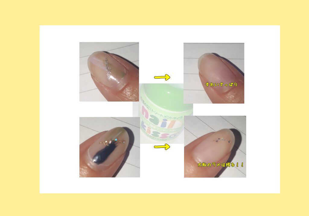 エルファー ネイルキッスA/DAISO/除光液を使ったクチコミ（2枚目）