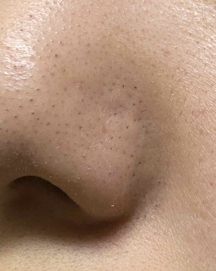 ハトムギ化粧水(ナチュリエ スキンコンディショナー R )/ナチュリエ/化粧水を使ったクチコミ(4枚目)