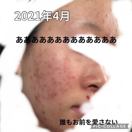 ハトムギ浸透乳液(ナチュリエ スキンコンディショニングミルク)/ナチュリエ/乳液を使ったクチコミ(5枚目)