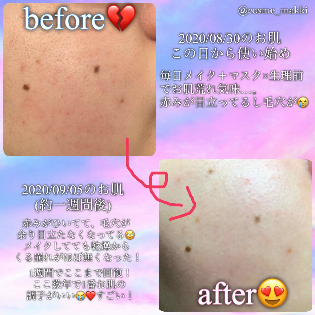 ジェニフィック アドバンスト N/LANCOME/美容液を使ったクチコミ(3枚目)