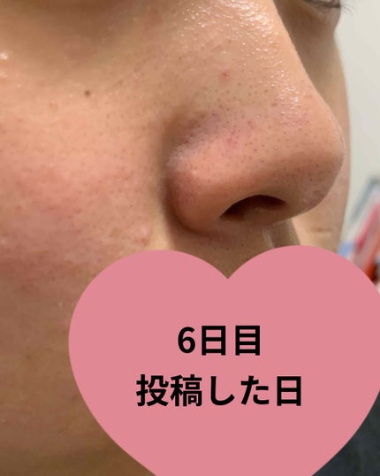 風(かぜ) on LIPS 「みなさん!お久しぶりです(*__)♡無印良品のスキンケア用品を..」(4枚目)