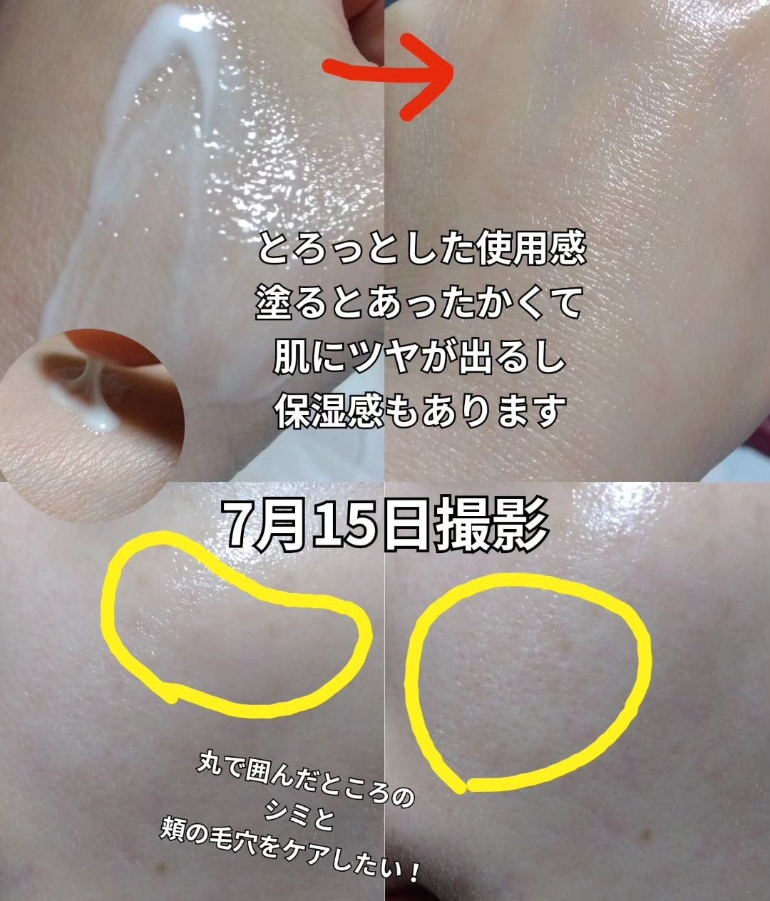 ビタペアC ビタレチ美容液/ネイチャーリパブリック/美容液を使ったクチコミ(3枚目)