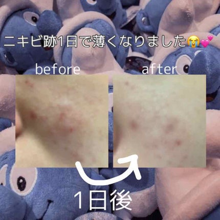 潤浸保湿 化粧水 III とてもしっとり/キュレル/化粧水を使ったクチコミ(1枚目)