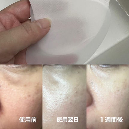 MELT AWAY AMPOULE MIST CENTELLA /KOPHER/ミスト状化粧水を使ったクチコミ(5枚目)