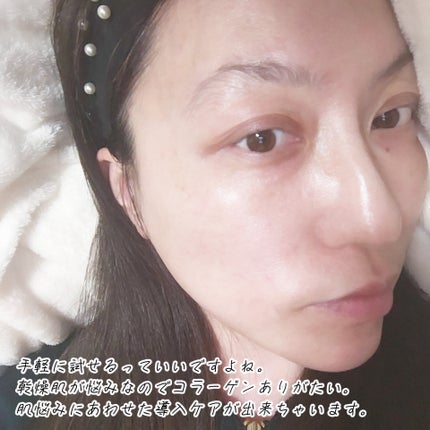 S100 コラーゲンリードル/VT/美容液を使ったクチコミ(4枚目)