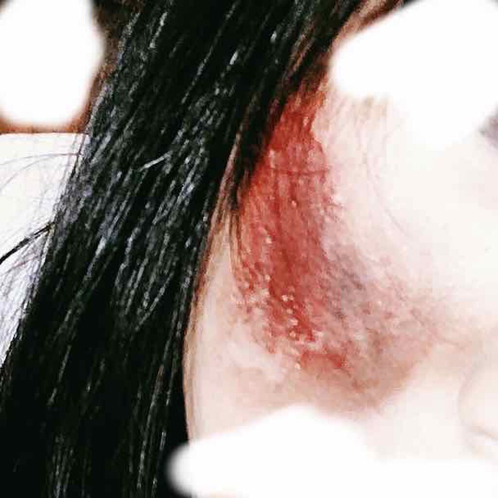 ディープピュア洗顔料/ダヴ/洗顔フォームを使ったクチコミ(3枚目)