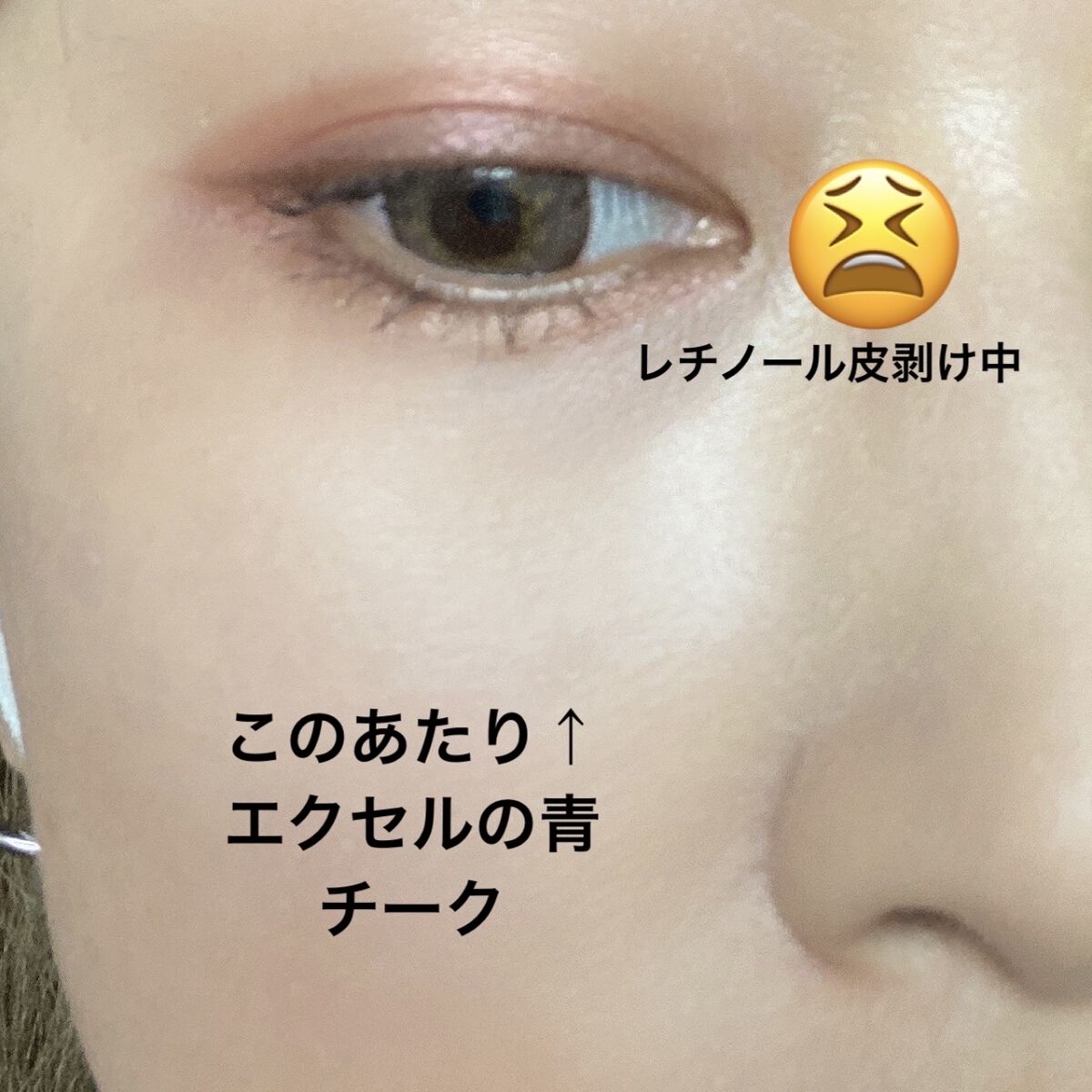 アディクション ザ ブラッシュ 007 Beach Life (M) ビーチライフ/ADDICTION/パウダーチークを使ったクチコミ（3枚目）