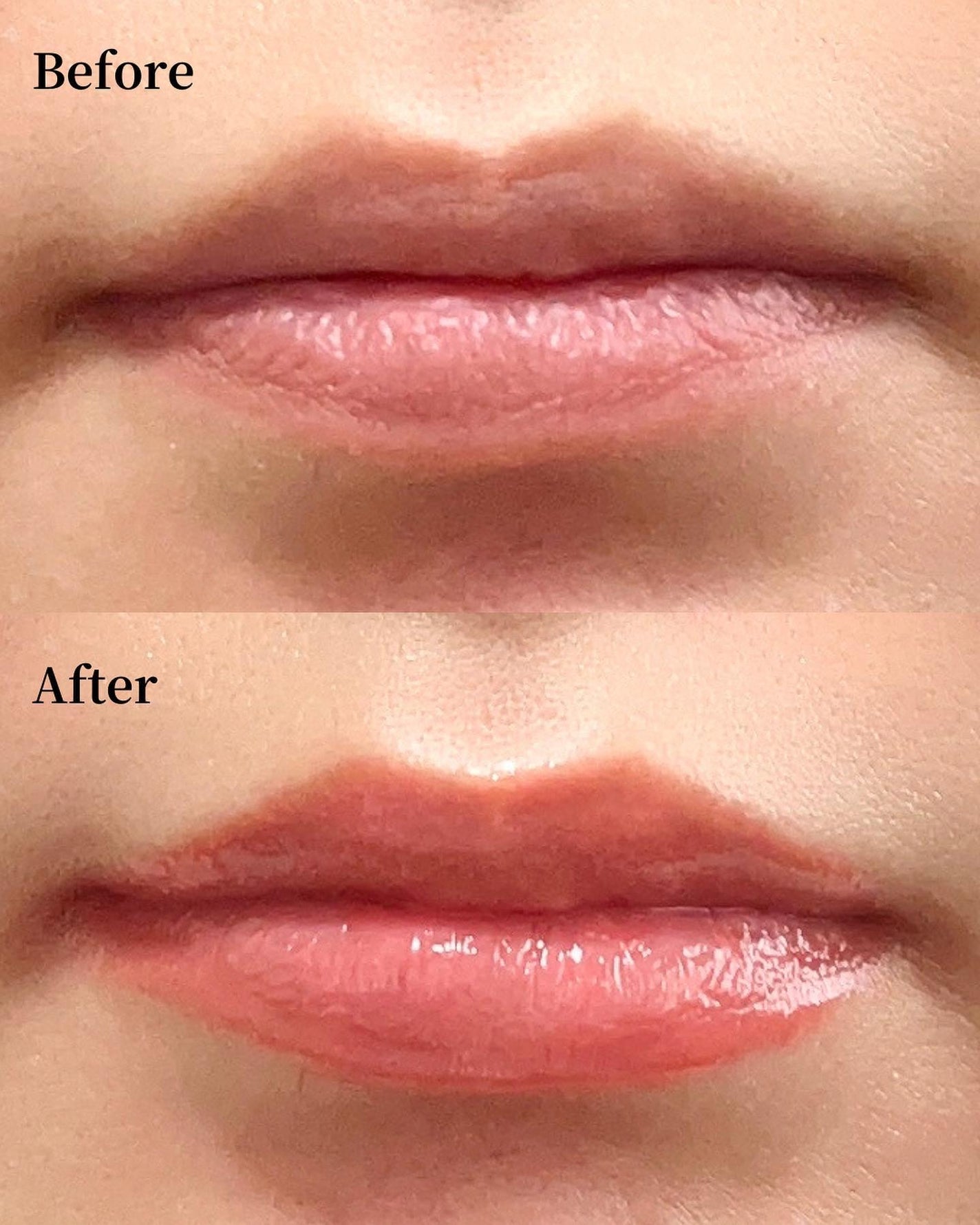 ドトムリッププラスプランパー/keybo/リッププランパーを使ったクチコミ(4枚目)