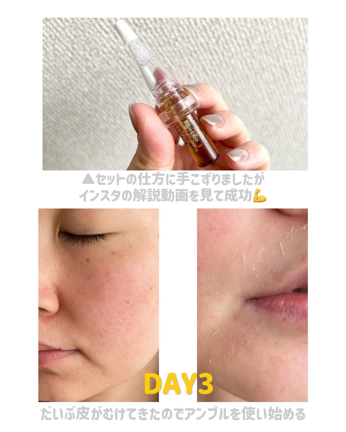 ダーマスキンピーリング/BQCELL/その他キットセットを使ったクチコミ(5枚目)