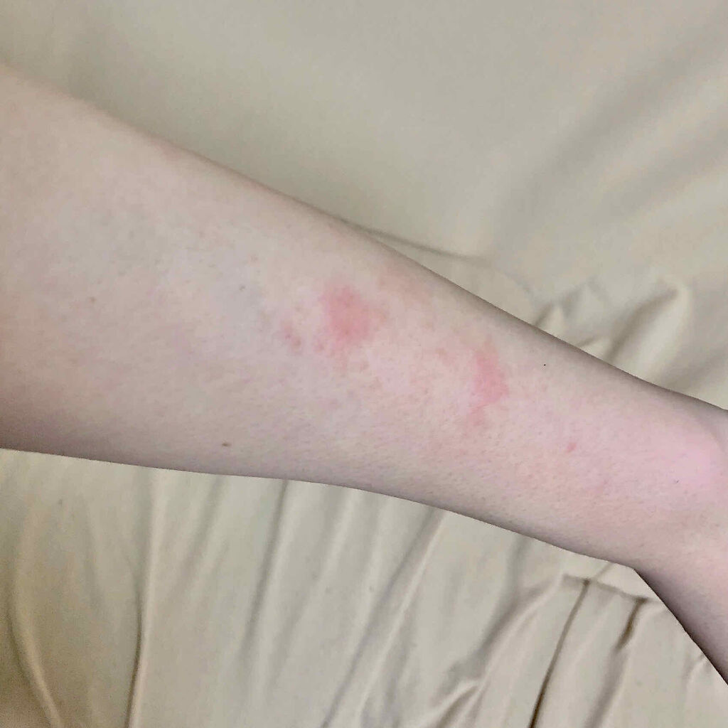 ハトムギ ベビーオイル/麗白/ボディオイルを使ったクチコミ（2枚目）