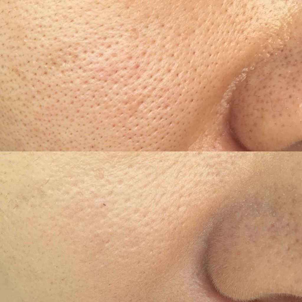 ラ プードル オートニュアンス/Elégance/プレストパウダーを使ったクチコミ（2枚目）