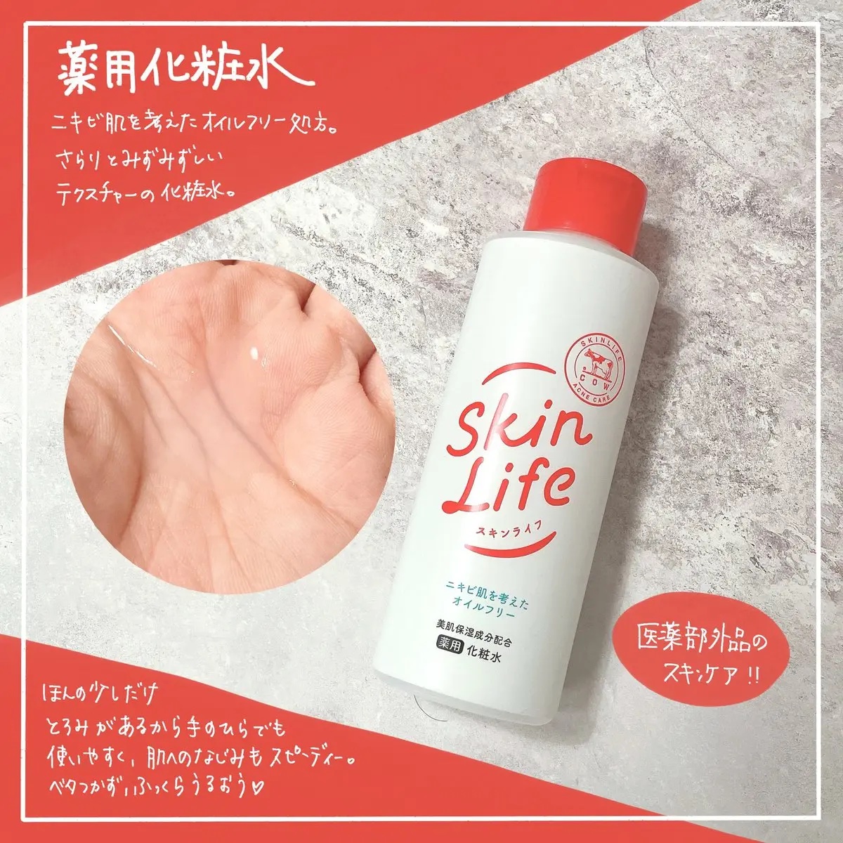 薬用泡のふんわり洗顔/スキンライフ/泡洗顔を使ったクチコミ（2枚目）