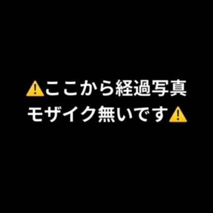 スカルプD ボーテ ピュアフリーアイラッシュセラム プレミアム/アンファー(スカルプD)/まつげ美容液を使ったクチコミ(5枚目)