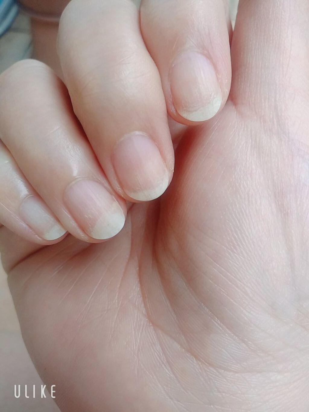 メディケイティッド/アトリックス/ハンドクリームを使ったクチコミ（1枚目）