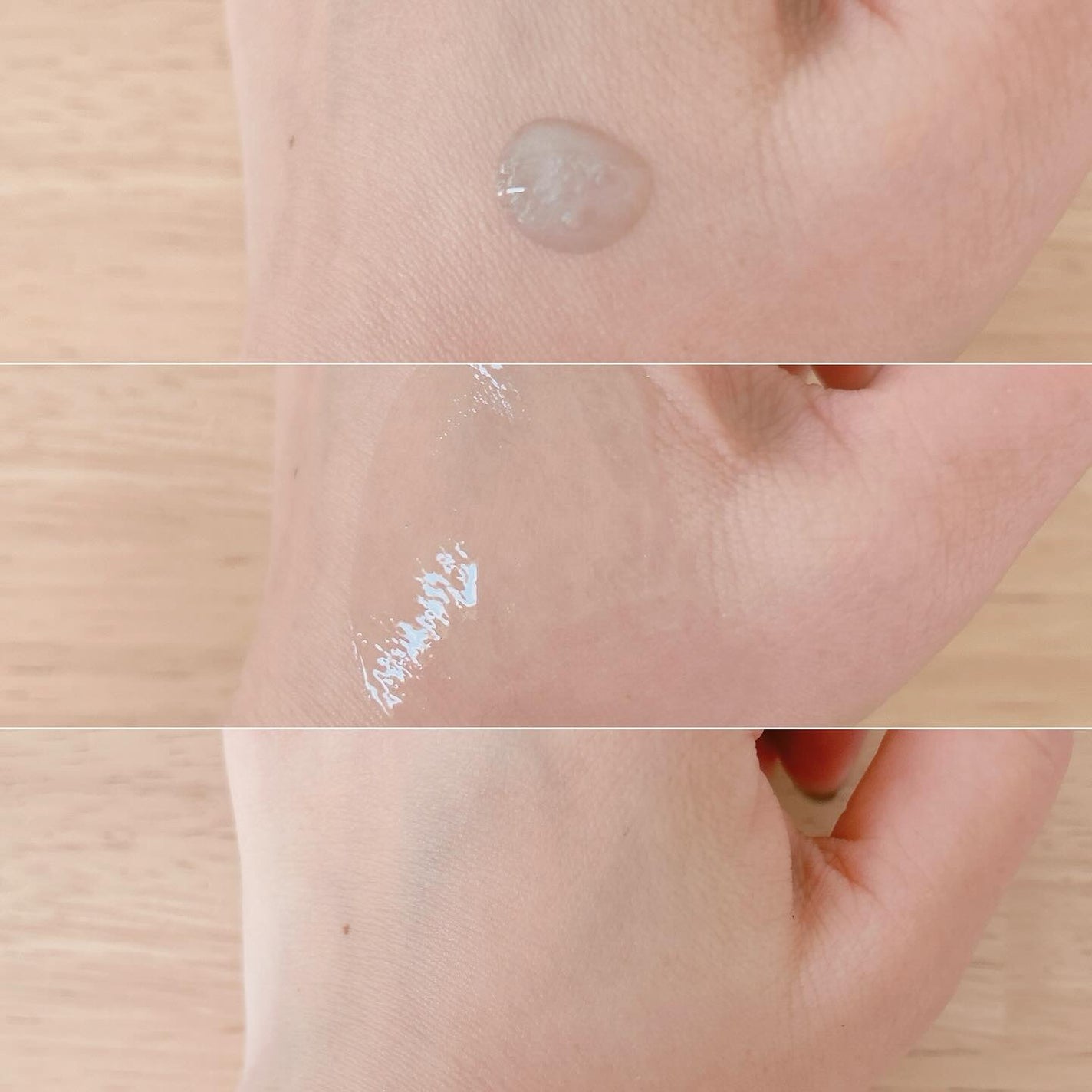 ニードルセラムAZ/fractionalCC/美容液を使ったクチコミ(2枚目)