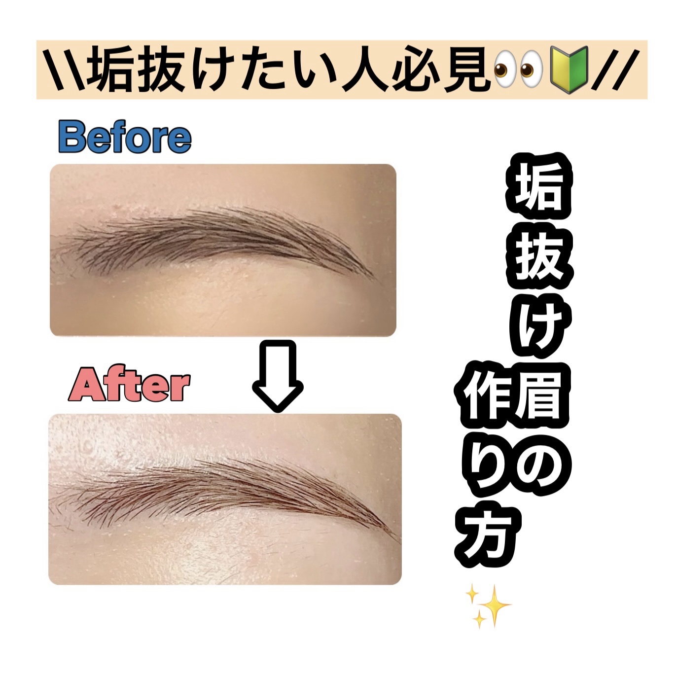 脱色クリーム 敏感肌用/エピラット/ムダ毛ケアを使ったクチコミ（1枚目）