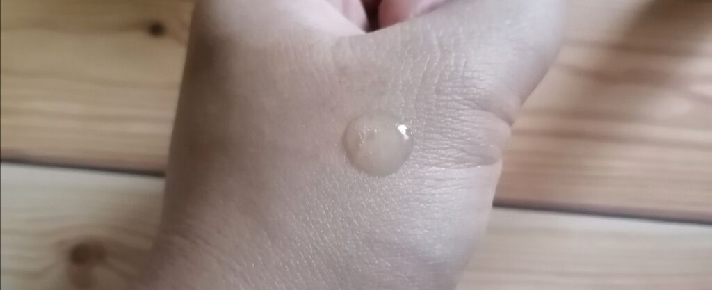 ACP 14 DAYS キット/AGILE COSMETICS PROJECT/スキンケアキットを使ったクチコミ(3枚目)